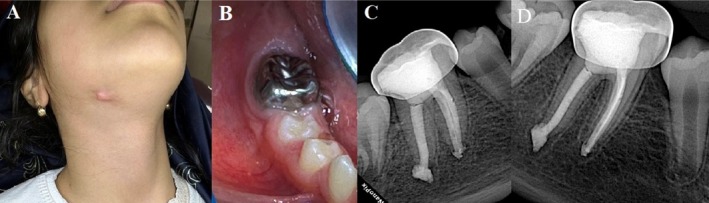 FIGURE 2