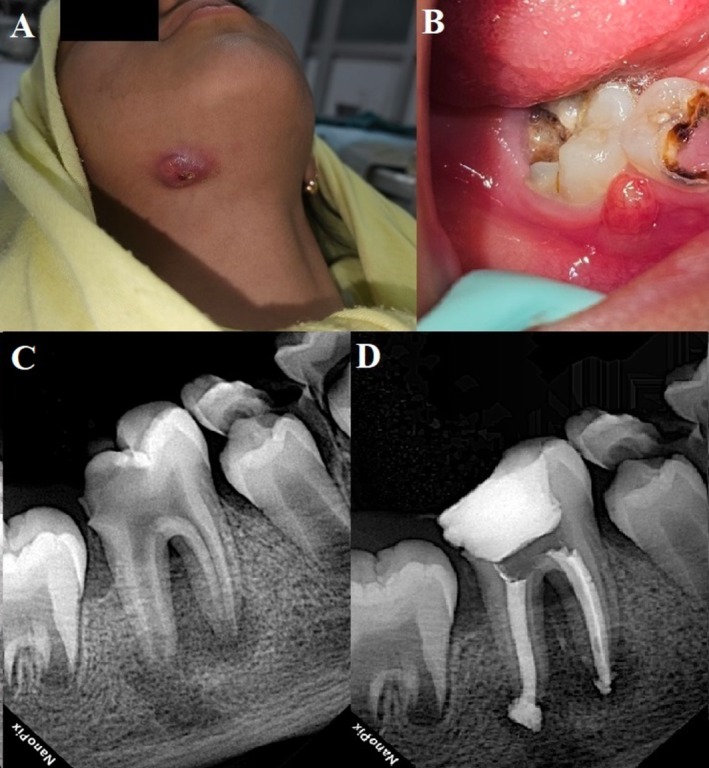 FIGURE 1