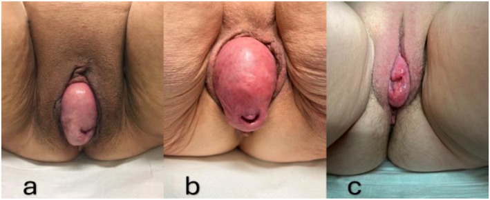 FIGURE 1