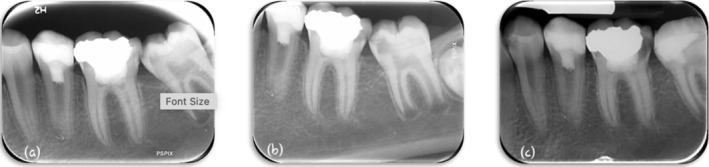 FIGURE 4