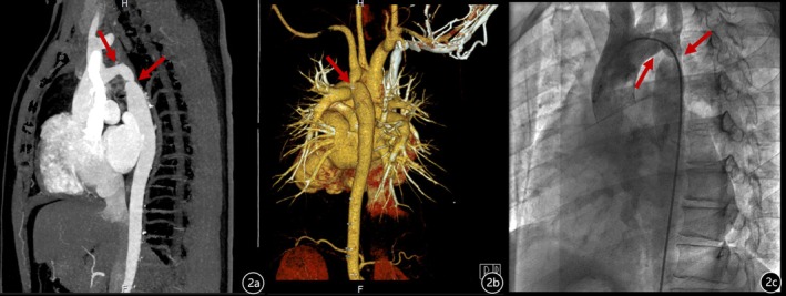 FIGURE 2