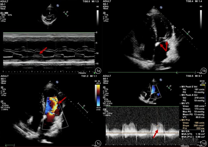 FIGURE 1