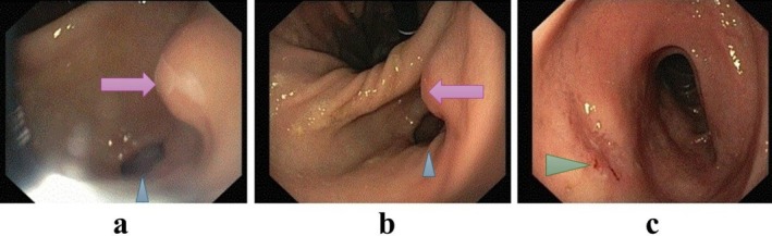 FIGURE 3