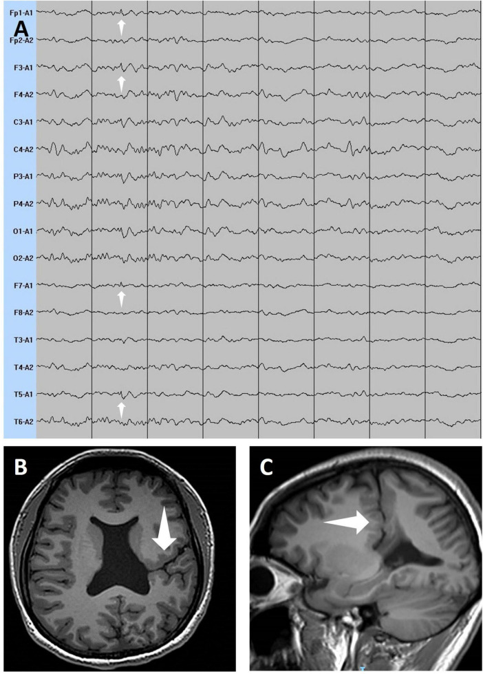 FIGURE 2
