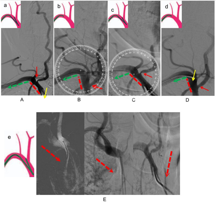 Figure 1