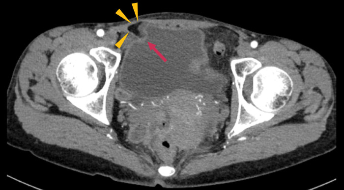 Fig. 1