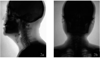 FIGURE 2