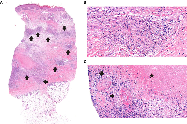 Figure 2