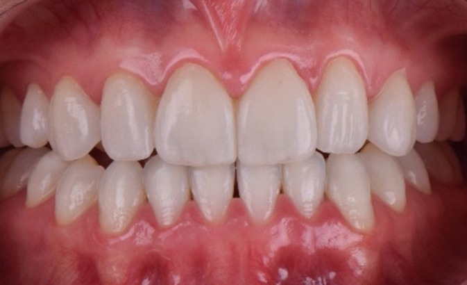 FIGURE 14