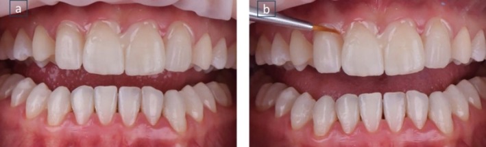 FIGURE 11