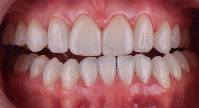 FIGURE 19