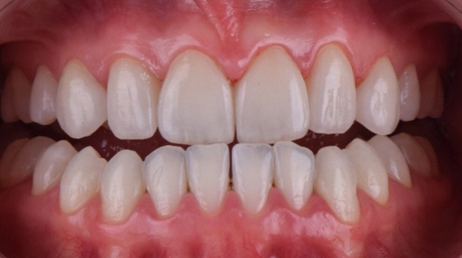 FIGURE 18