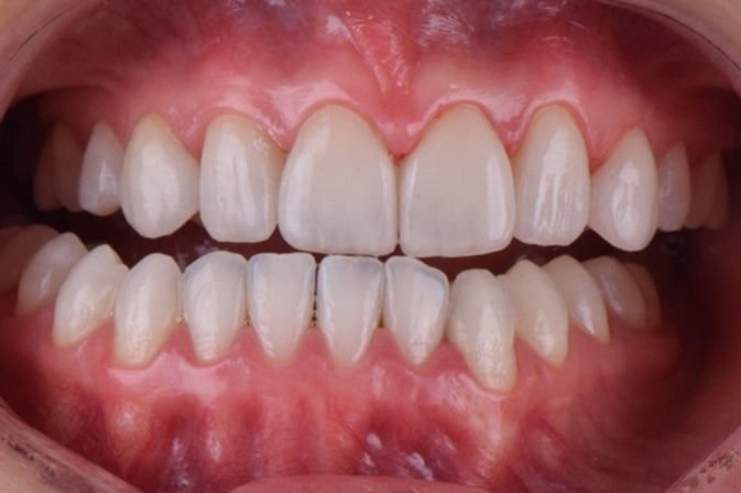 FIGURE 13