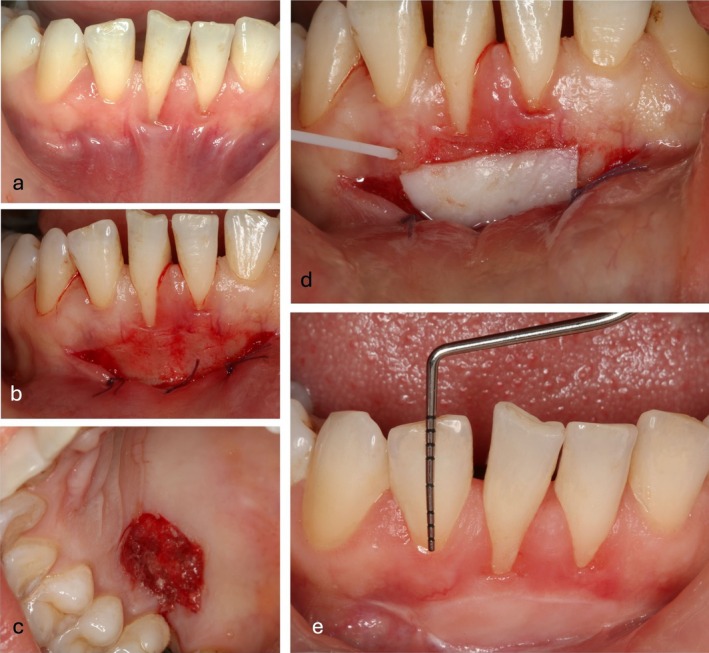 FIGURE 2
