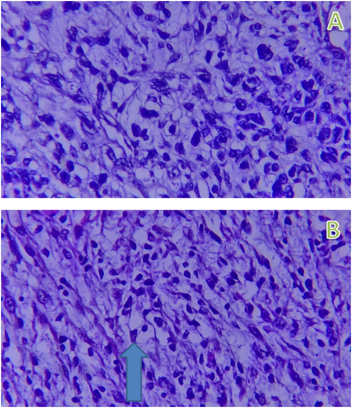 Figure 9