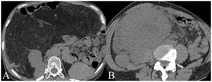 Figure 2