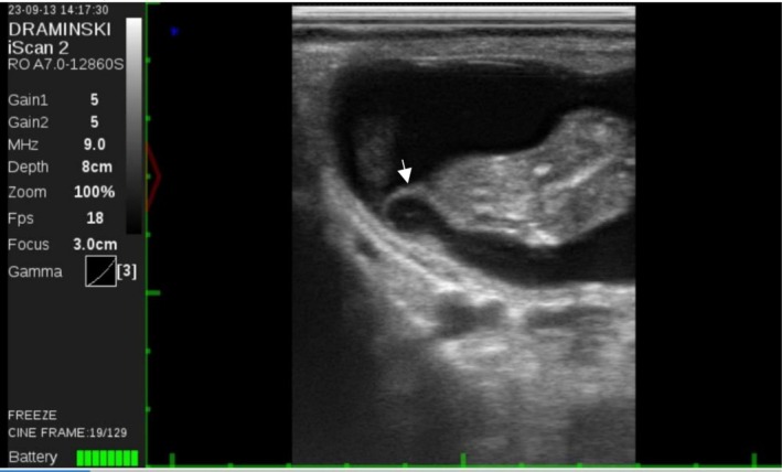 FIGURE 3