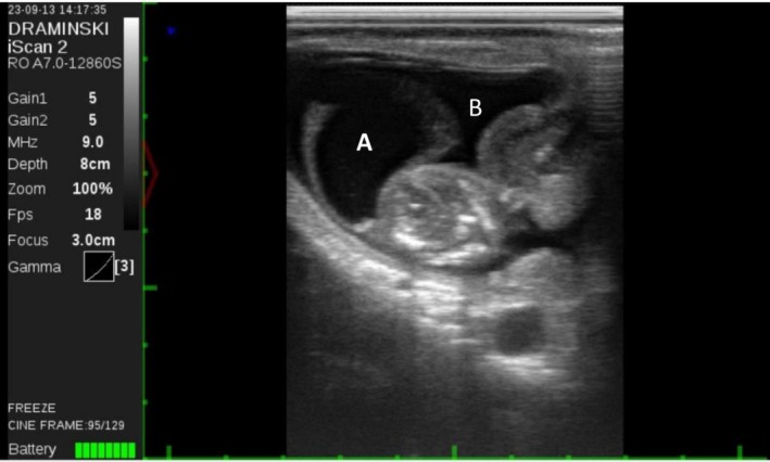 FIGURE 2