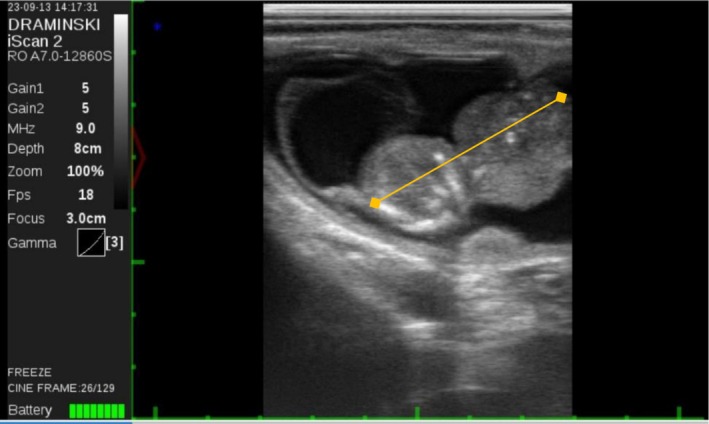 FIGURE 1