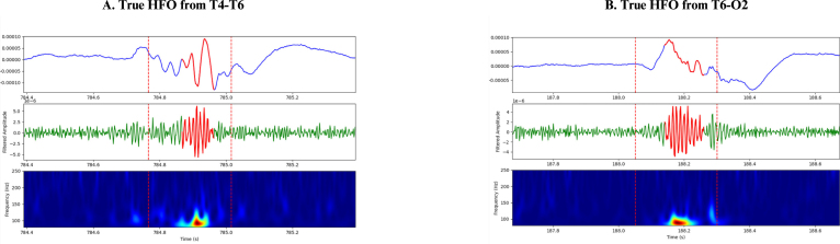 Figure 11