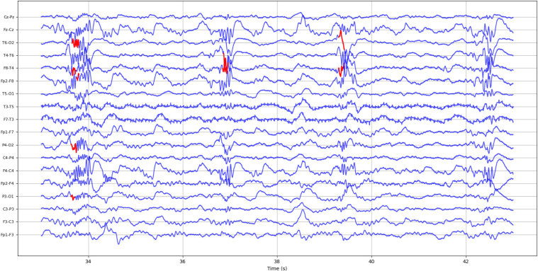 Figure 12