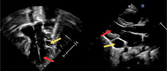 Fig. 4