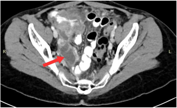 Fig. 2