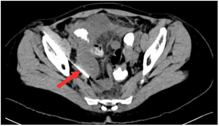 Fig. 3