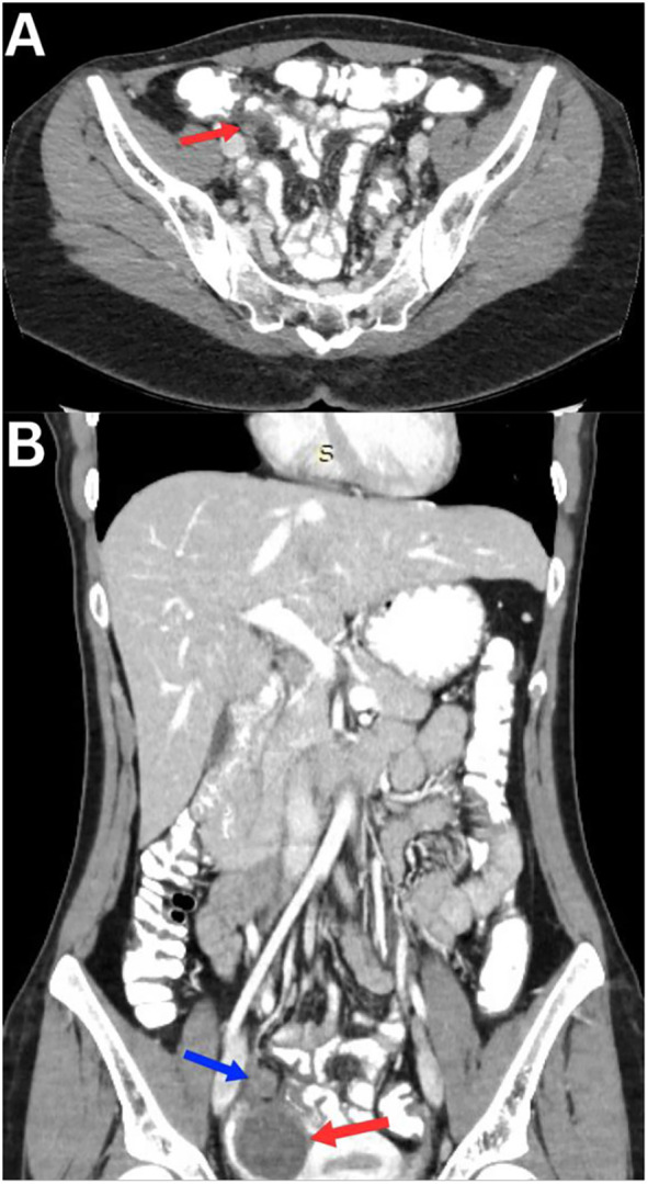 Fig. 4
