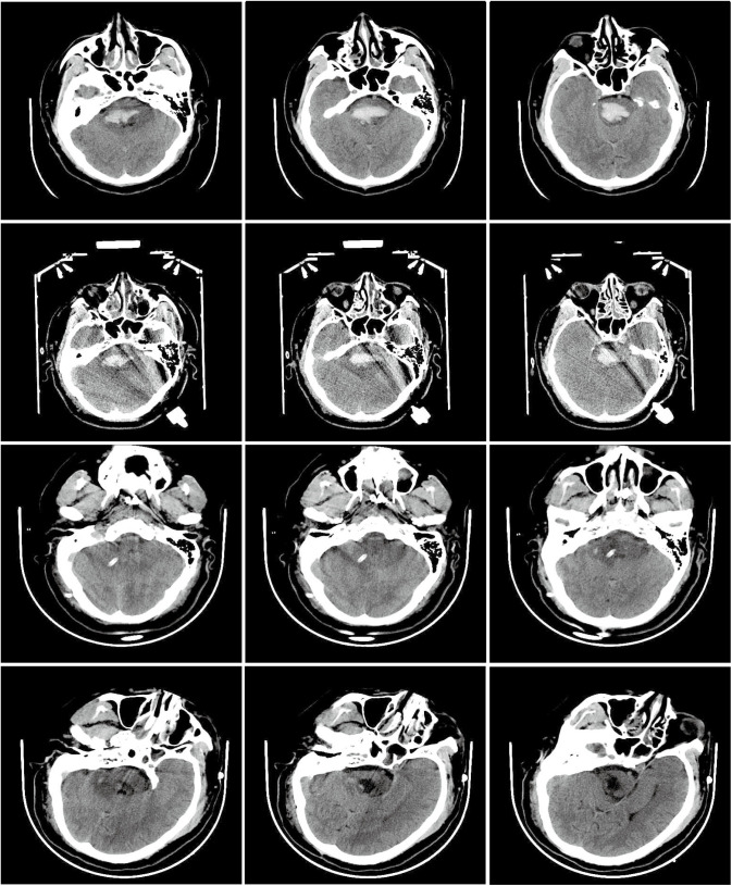 Fig 2