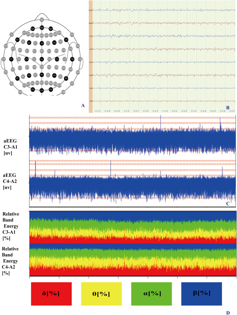 Fig 4