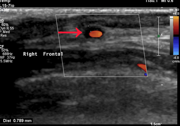 Figure 4