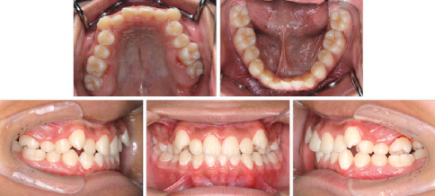 Figure 11