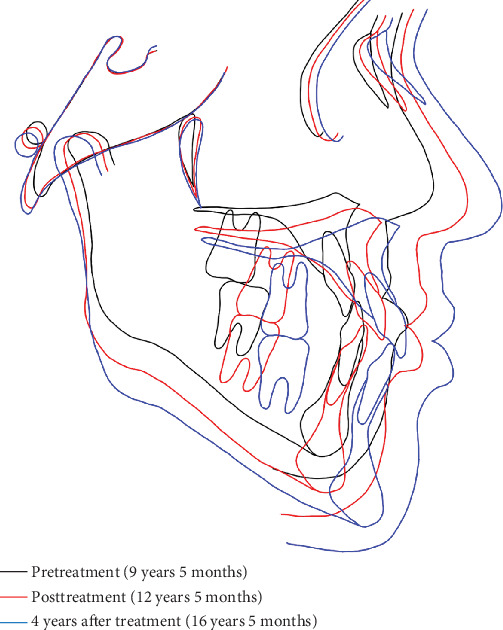 Figure 13