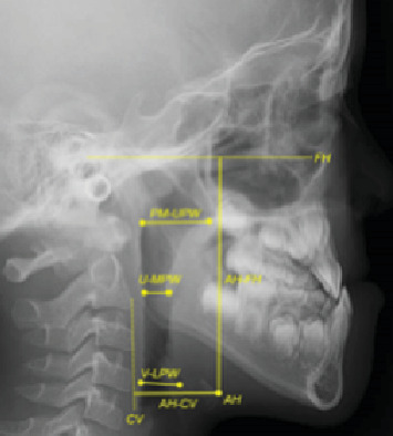 Figure 14