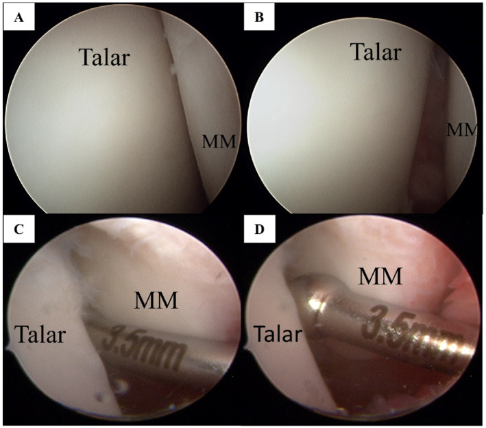 FIGURE 2