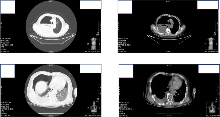 Figure 1