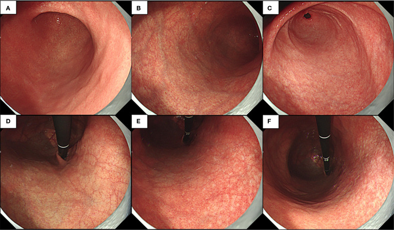 Figure 3