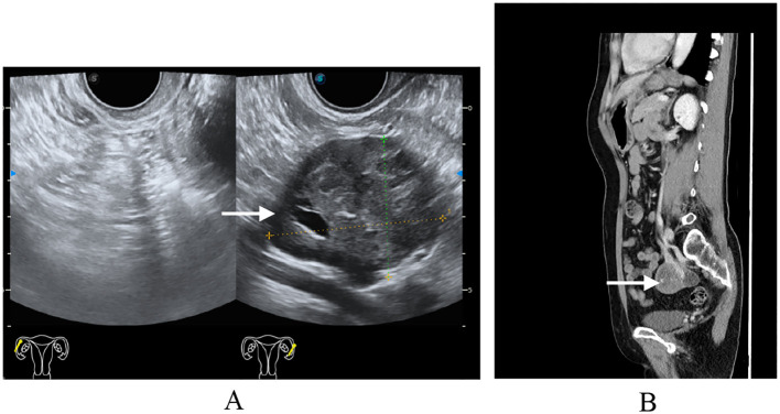 Figure 1