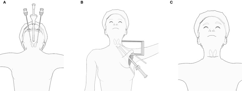 Figure 2