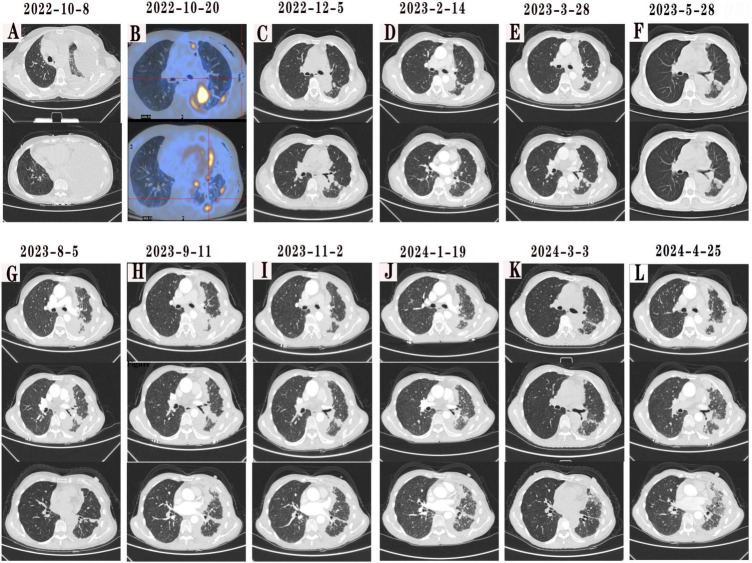FIGURE 1