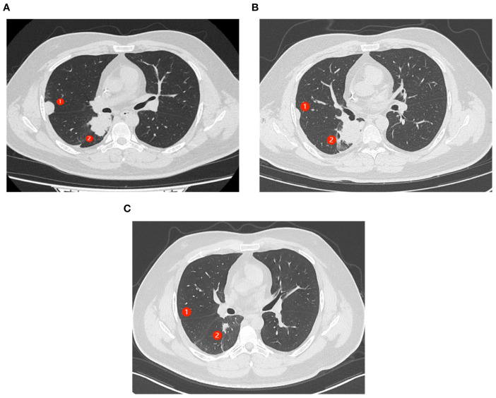 Figure 2