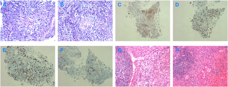 Figure 2