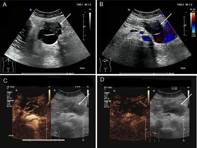Figure 1
