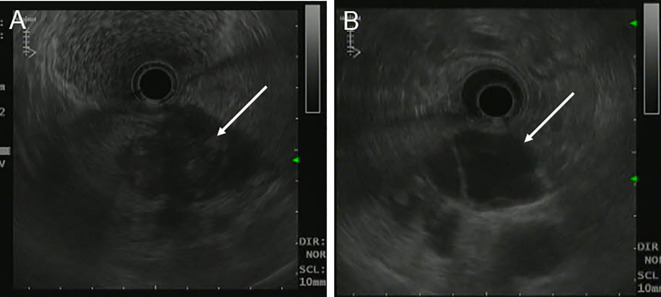 Figure 2