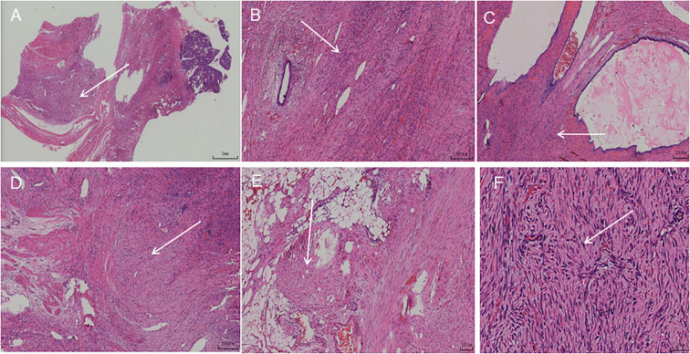 Figure 4