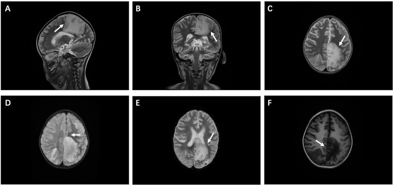 Figure 1