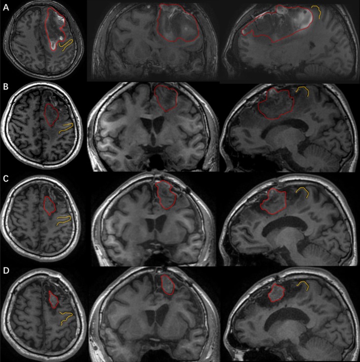 FIGURE 3