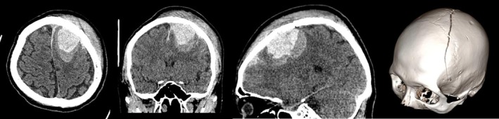 FIGURE 1