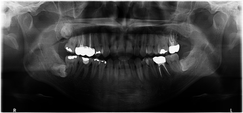 Figure 14